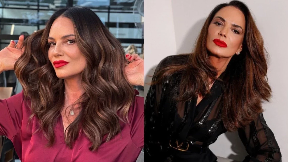 De modelo a cantor pop: Vitiligo e os famosos que sofrem da doença - imagem 139088