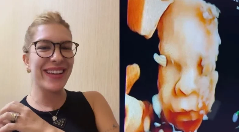 Grávida, Lore Improta faz ultrassom e brinca sobre aparência do bebê: “A cara do pai”