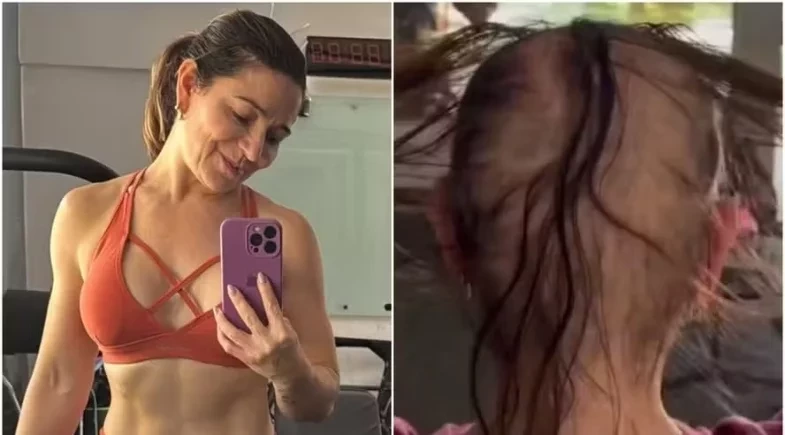 Mãe de Lucas Lucco esclarece queda de cabelo e rebate rumores: “Nunca escondi“