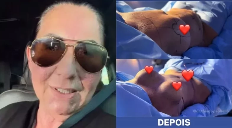 Mãe de Virginia Fonseca recebe alta após cirurgias plásticas: “Estou ótima”