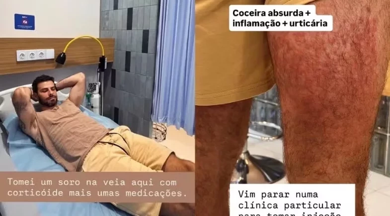 Ex-ator da Globo é internado após ataque de ácaros na Indonésia: “Fui devorado”