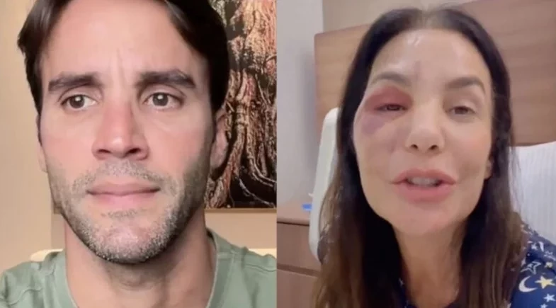 Ex-marido de Ivete Sangalo atualiza estado de saúde após cirurgia