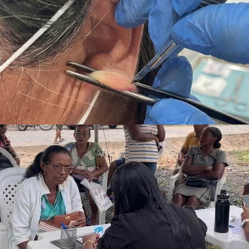 Moradores da localidade L3 recebem atendimentos em ação de saúde itinerante - Foto: Prefeitura de Floriano