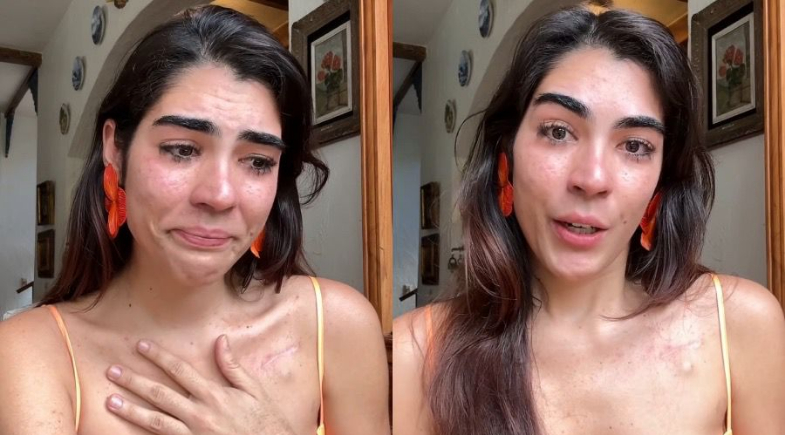 Ananda Paixão é diagnosticada com câncer pela 3ª vez: “Metástase”