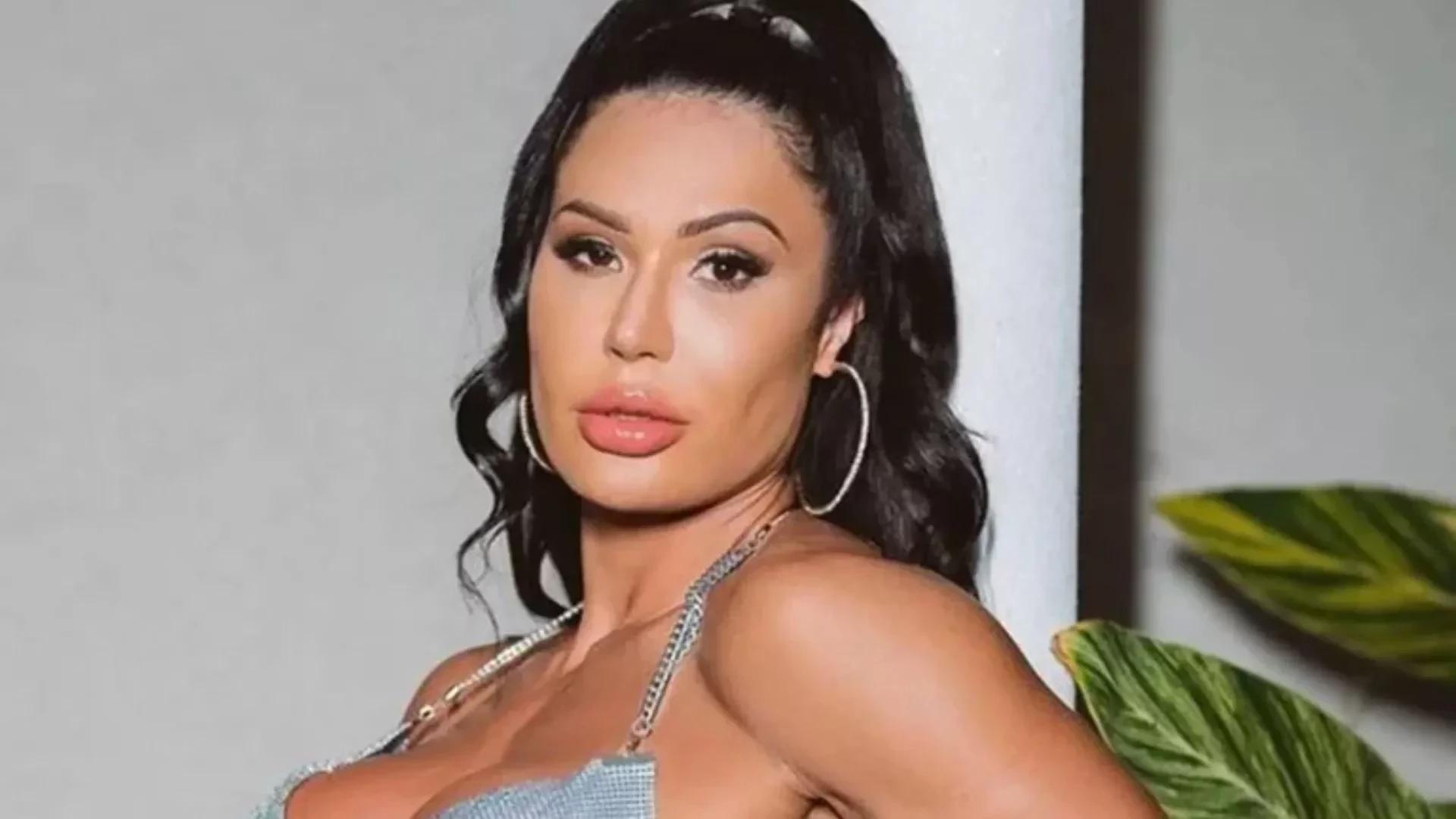 Além de Aline Campos, relembre ex-BBBs que reverteram procedimentos estéticos - imagem 142202