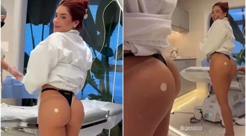 Gkay dá turbinada no bumbum após o Carnaval e médico brinca: “Vale um apartamento”