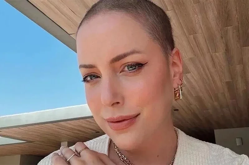 Relembre famosos que já lutaram ou ainda lutam contra o câncer - imagem 141401