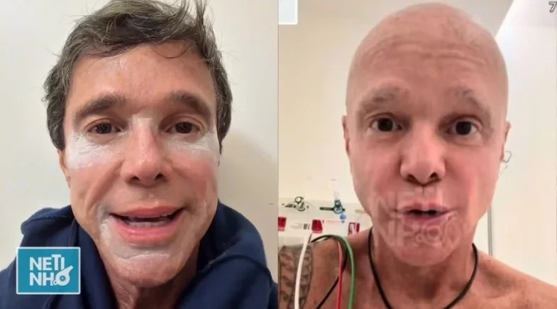Cantor Netinho revela que fará duas biópsias após volta de câncer: “Cabeça erguida”