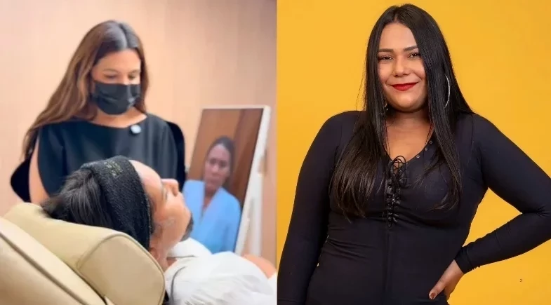 Ex-BBB Chaiany Andrade mostra resultado de harmonização facial; compare!