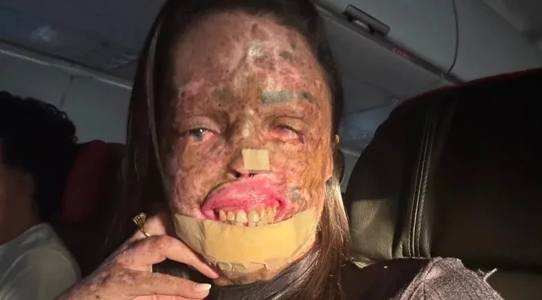 Influenciadora Karine Felipe morre aos 37 anos após luta contra doença genética rara