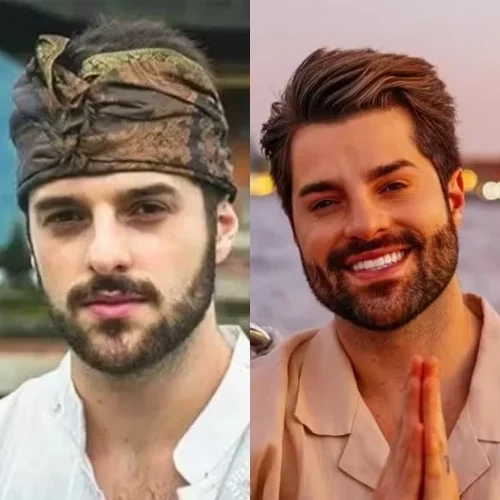 Simone Mendes e outros famosos que mudaram muito após procedimentos estéticos - imagem 151154