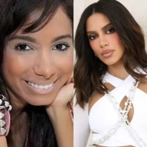 Simone Mendes e outros famosos que mudaram muito após procedimentos estéticos - imagem 151150