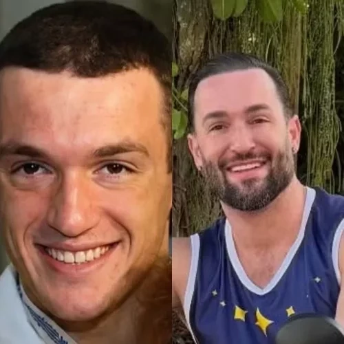 Simone Mendes e outros famosos que mudaram muito após procedimentos estéticos - imagem 151156