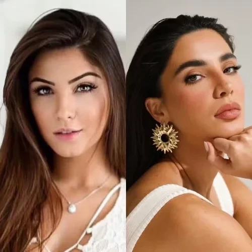 Simone Mendes e outros famosos que mudaram muito após procedimentos estéticos - imagem 151155