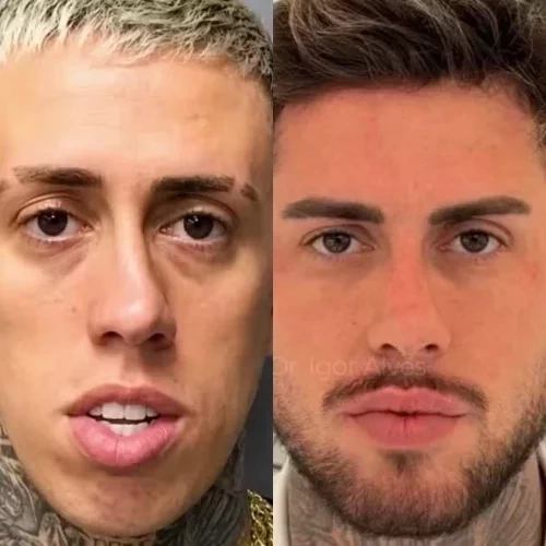 Simone Mendes e outros famosos que mudaram muito após procedimentos estéticos - imagem 151152