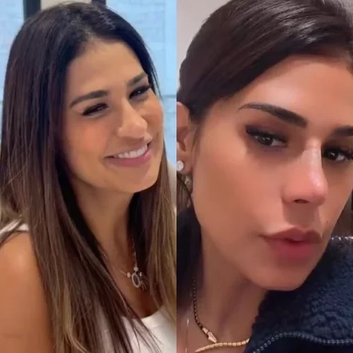 Simone Mendes e outros famosos que mudaram muito após procedimentos estéticos - imagem 151147