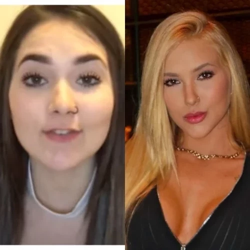 Simone Mendes e outros famosos que mudaram muito após procedimentos estéticos - imagem 151149