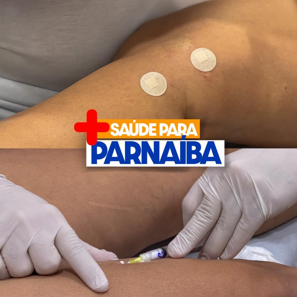 Parnaíba realiza mutirão de varizes e ultrapassa 4 mil procedimentos - Imagem 2